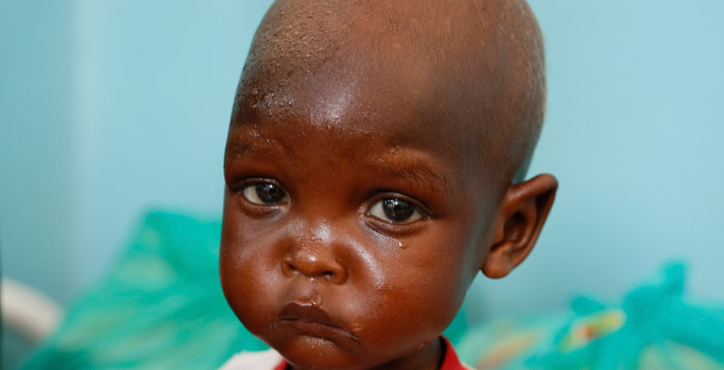 Malnutrition